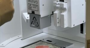 Pioneros en el norte del país: Hospital de La Serena utiliza impresora 3d de tejidos para tratar pacientes con heridas complejas.